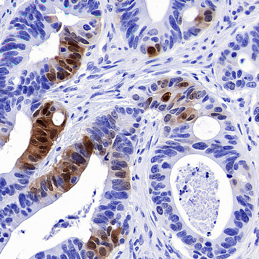 Phospho-p44/42 MAPK (Erk1/2) (Thr202/Tyr204) Recombinant Rabbit mAb (S-5119)