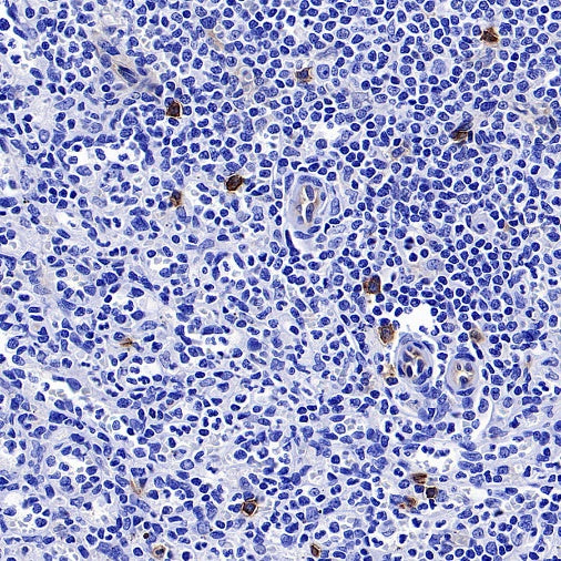 CD123 Recombinant Rabbit mAb (S-1592-12)