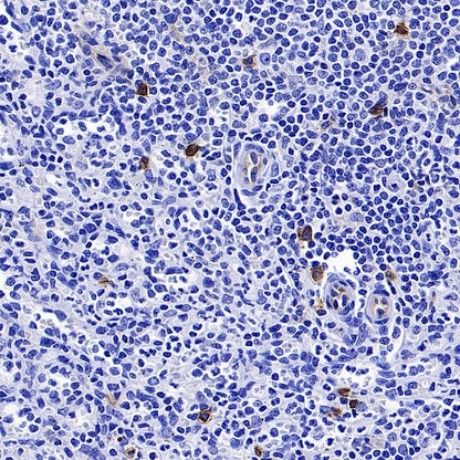 CD123 Recombinant Rabbit mAb (S-1592-12)