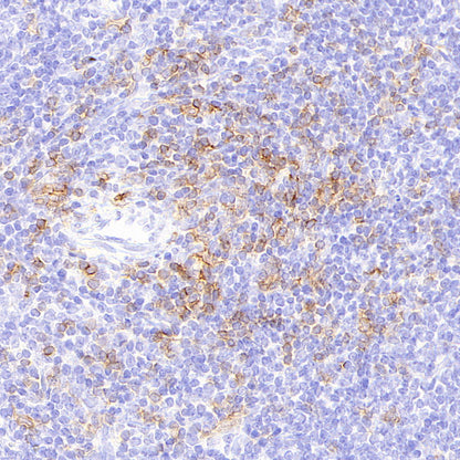 CD8α Recombinant Rabbit mAb (S-6201)