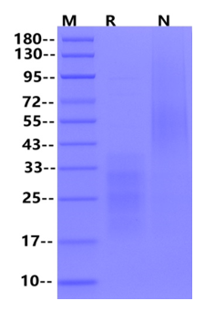 IL-31 Protein, Mouse