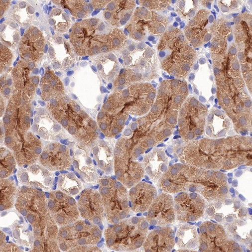COX2 Recombinant Rabbit mAb (S-870-18)