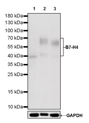B7-H4 Recombinant Rabbit mAb (SDT-314-447-2)