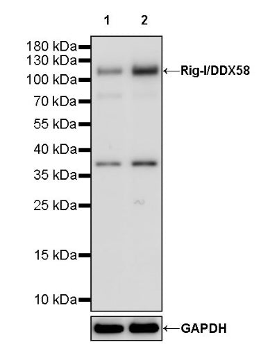 Rig-I/DDX58 Recombinant Rabbit mAb (S-1419-114)