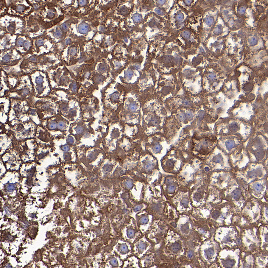 Ferritin Heavy Chain Recombinant Rabbit mAb (S-5419)
