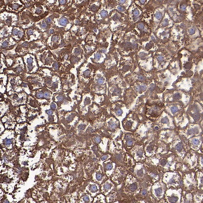 Ferritin Heavy Chain Recombinant Rabbit mAb (S-5419)