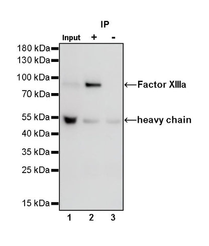 Factor XIIIa Recombinant Rabbit mAb (SDT-644-7)