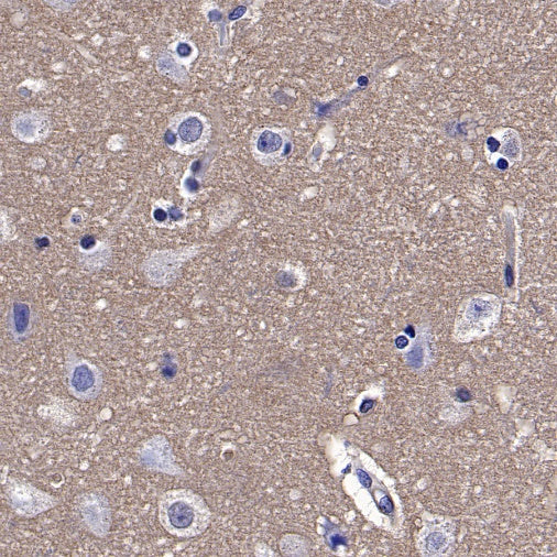 MIF Recombinant Rabbit mAb (S-1007-34)