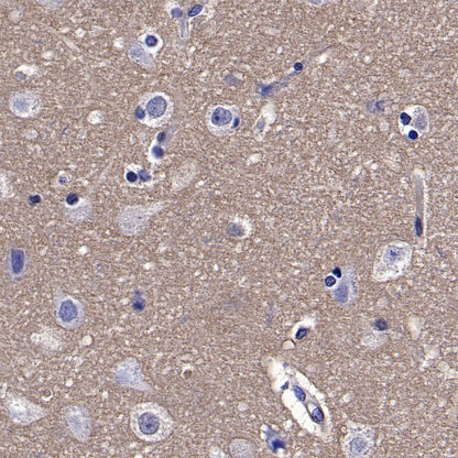 MIF Recombinant Rabbit mAb (S-1007-34)