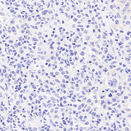 CD19 Mouse mAb (S-1039-46)