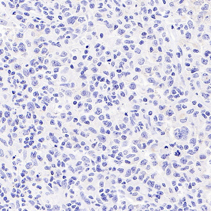 CD19 Mouse mAb (S-1039-46)