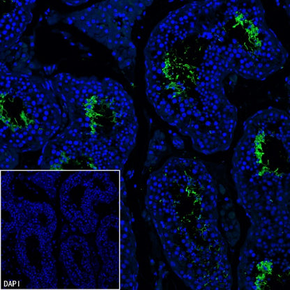 AKAP4 Recombinant Rabbit mAb (SDT-4196)