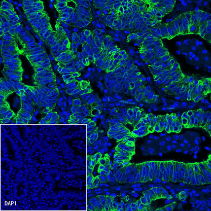 CK-LMW Recombinant Rabbit mAb (SDT-P003)