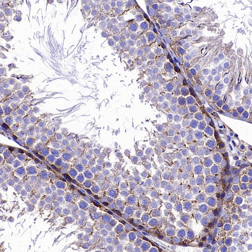ATP7A Recombinant Rabbit mAb (S-2289-106)