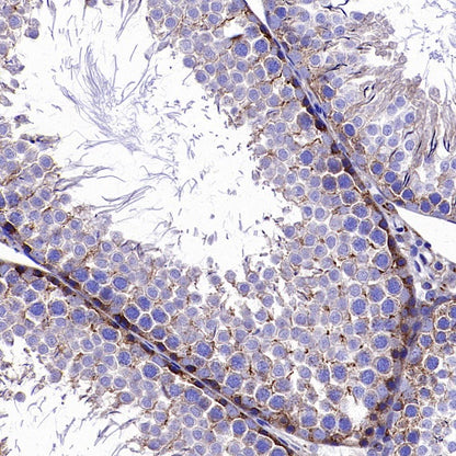 ATP7A Recombinant Rabbit mAb (S-2289-106)
