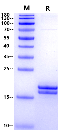 Biotinylated IL-2 His Tag Protein, Human
