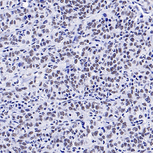 RNF40 Recombinant Rabbit mAb (S-1068-279)