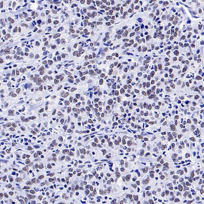 RNF40 Recombinant Rabbit mAb (S-1068-279)