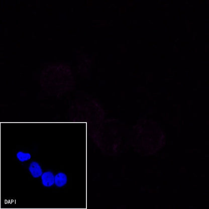 CD19 Recombinant Rabbit mAb (Cy5 Conjugate) (S-164-41)