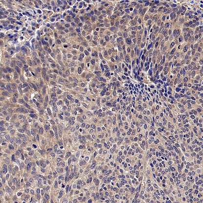 WSB1 Recombinant Rabbit mAb (S-3505-23)