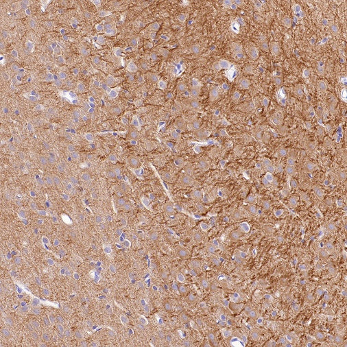 MAP2 Recombinant Rabbit mAb (S-3110-72)