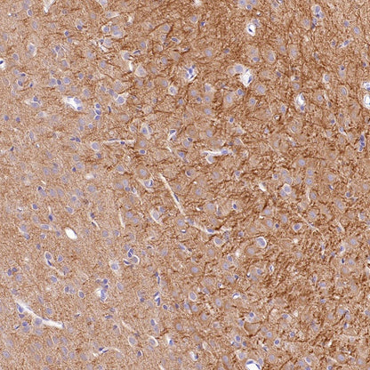 MAP2 Recombinant Rabbit mAb (S-3110-72)