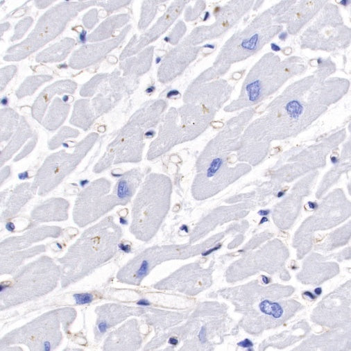 Non-muscle Myosin IIB/MYH10 Recombinant Rabbit mAb (S-299-3)