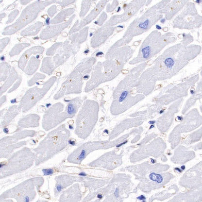 Non-muscle Myosin IIB/MYH10 Recombinant Rabbit mAb (S-299-3)