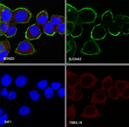 NaPi2b/SLC34A2 Recombinant Rabbit mAb (SDT-R229)