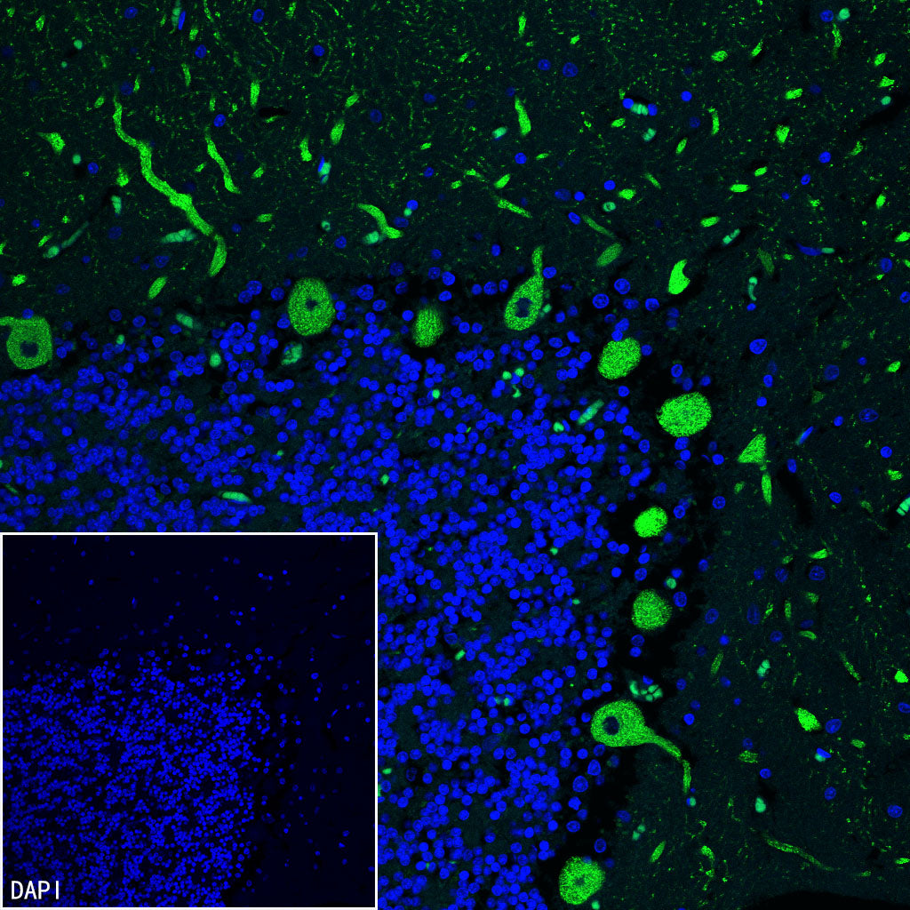 ITPR1 Recombinant Rabbit mAb (S-4530-47)