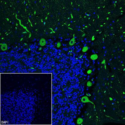 ITPR1 Recombinant Rabbit mAb (S-4530-47)
