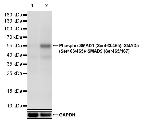 Phospho-SMAD1 (Ser463/465)/ SMAD5 (Ser463/465)/ SMAD9 (Ser465/467) Recombinant Rabbit mAb (S-3412)
