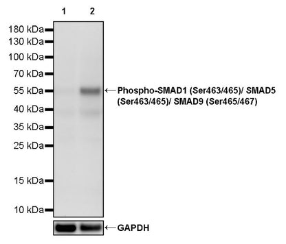 Phospho-SMAD1 (Ser463/465)/ SMAD5 (Ser463/465)/ SMAD9 (Ser465/467) Recombinant Rabbit mAb (S-3412)