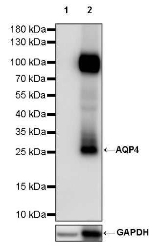 AQP4 Recombinant Rabbit mAb (S-1609-62)