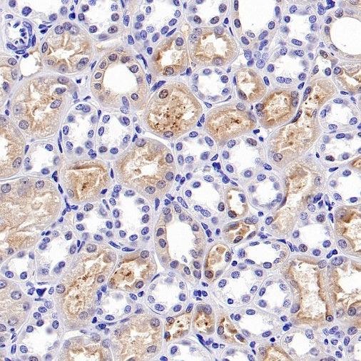 p90RSK Recombinant Rabbit mAb (S-1024-26)