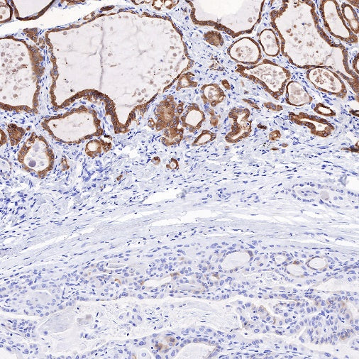 TPO Recombinant Rabbit mAb (SDT-420-57-1)