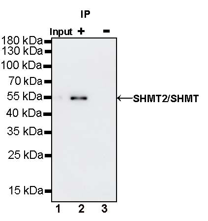 SHMT2/SHMT Recombinant Rabbit mAb (S-1581-5)