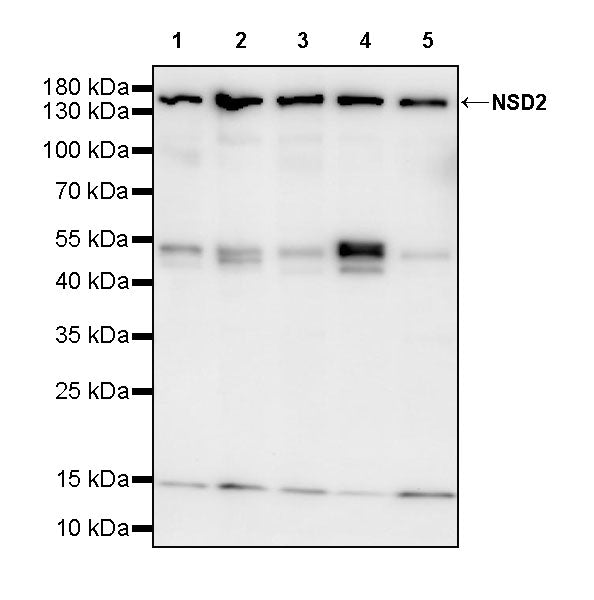 NSD2 Recombinant Rabbit mAb (S-4013-46)
