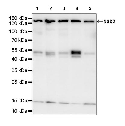 NSD2 Recombinant Rabbit mAb (S-4013-46)