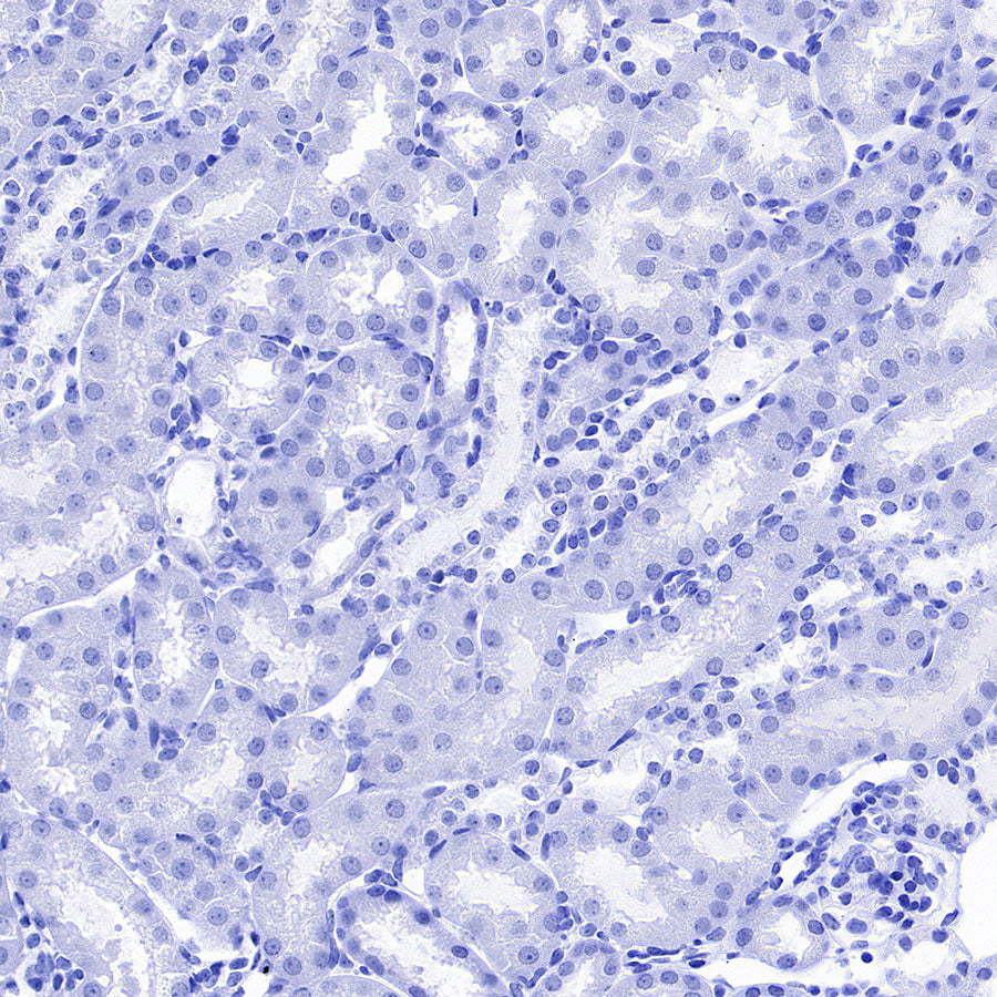 PMP22 Recombinant Rabbit mAb (S-5305)