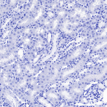 PMP22 Recombinant Rabbit mAb (S-5305)
