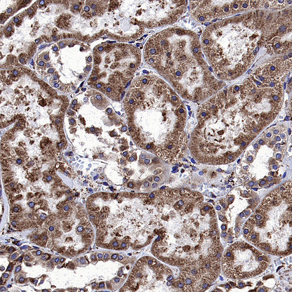 Calreticulin Recombinant Rabbit mAb (S-3920-39)