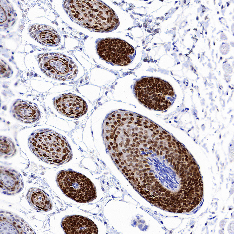 DLX3 Recombinant Rabbit mAb (S-4140-2)