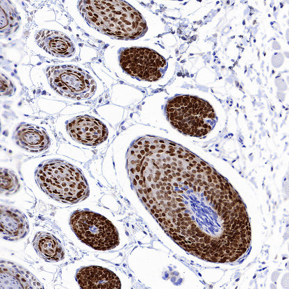 DLX3 Recombinant Rabbit mAb (S-4140-2)