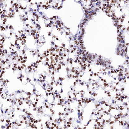 Histone H4 (acetyl K16) Recombinant Rabbit mAb (S-1482-12)