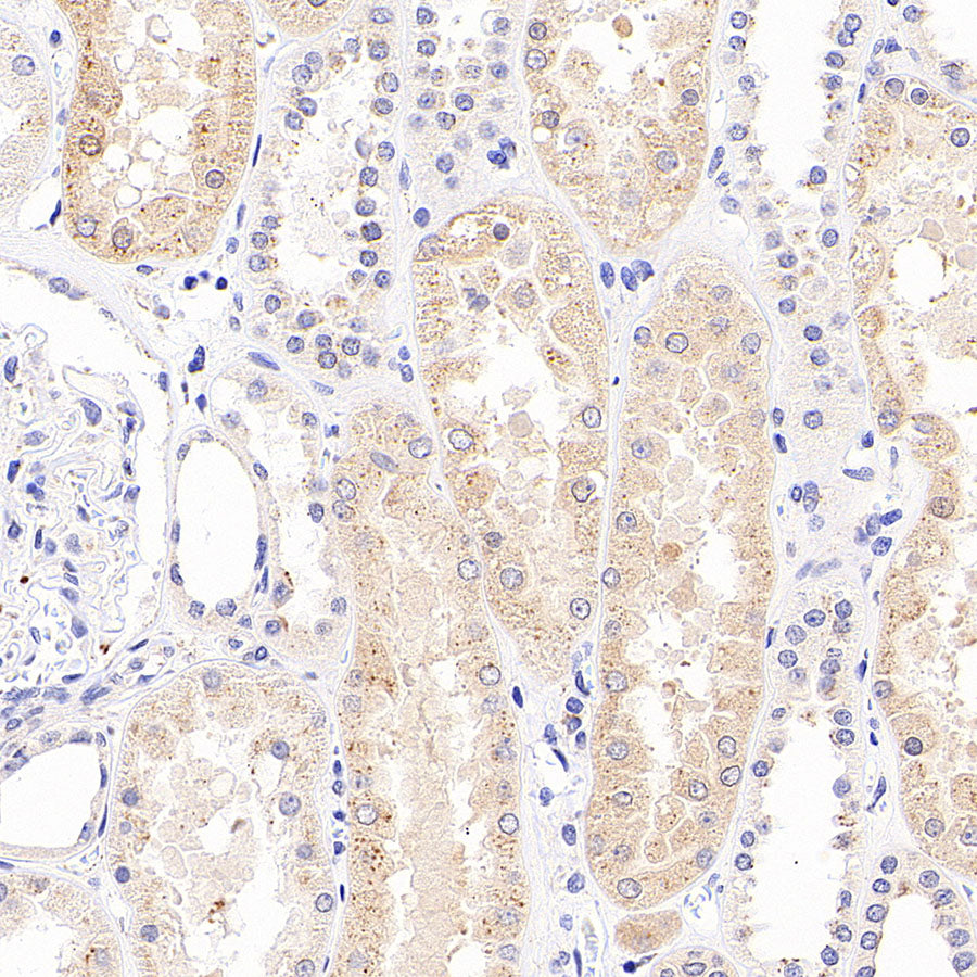 SEC24D Rabbit Polyclonal Antibody