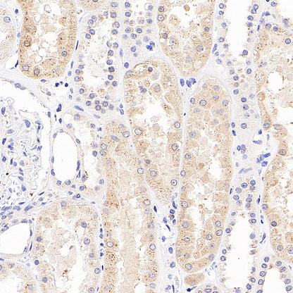 SEC24D Rabbit Polyclonal Antibody