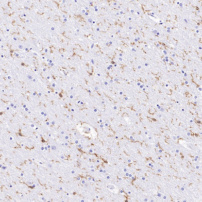 P2ry12 Recombinant Rabbit mAb (SDT-3134-52)