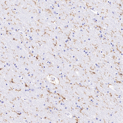 P2ry12 Recombinant Rabbit mAb (SDT-3134-52)