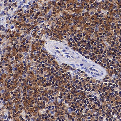 PPIA Recombinant Rabbit mAb (S-2406-28)